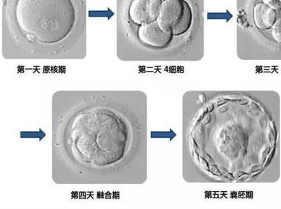 梅州梅江区可以做试管婴儿吗，梅州梅江区可以做试管婴儿吗多少钱